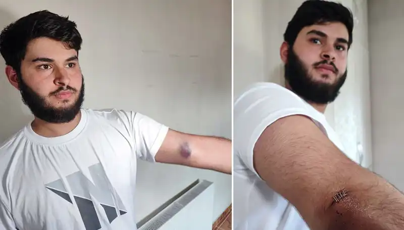 Bahçeye Kaçan Top Mahallenin İki Tarafını Karşı Karşıya Getirdi
